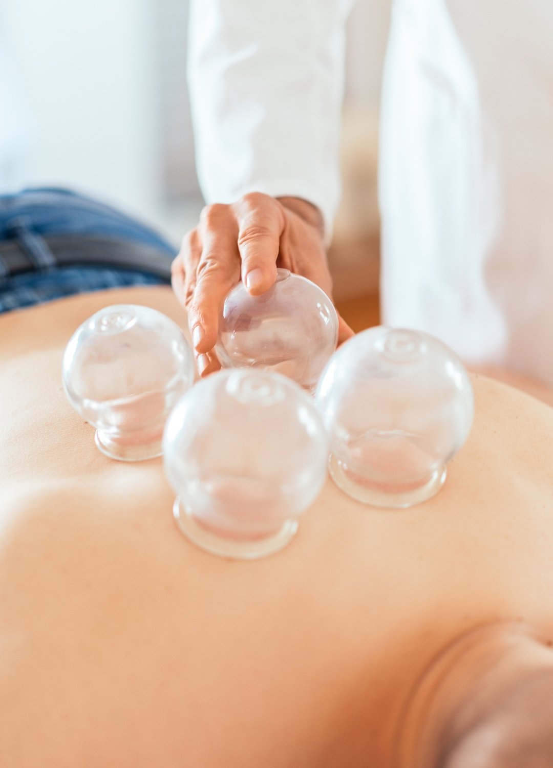 Ryo Acupuncture – Additional TCM Treatments